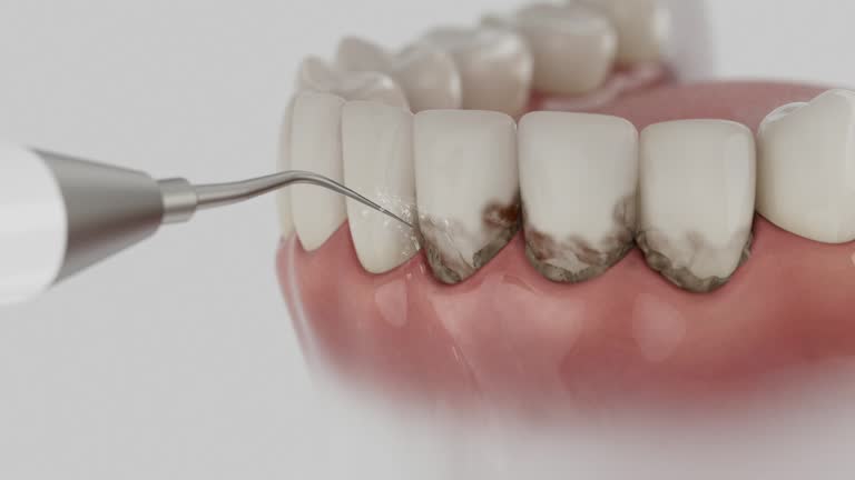 Trusted Tooth Extraction service in Varnell, GA - Dentist Open Now